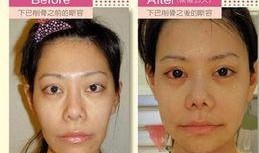 整形天后在线观看,揭秘美丽背后的秘密